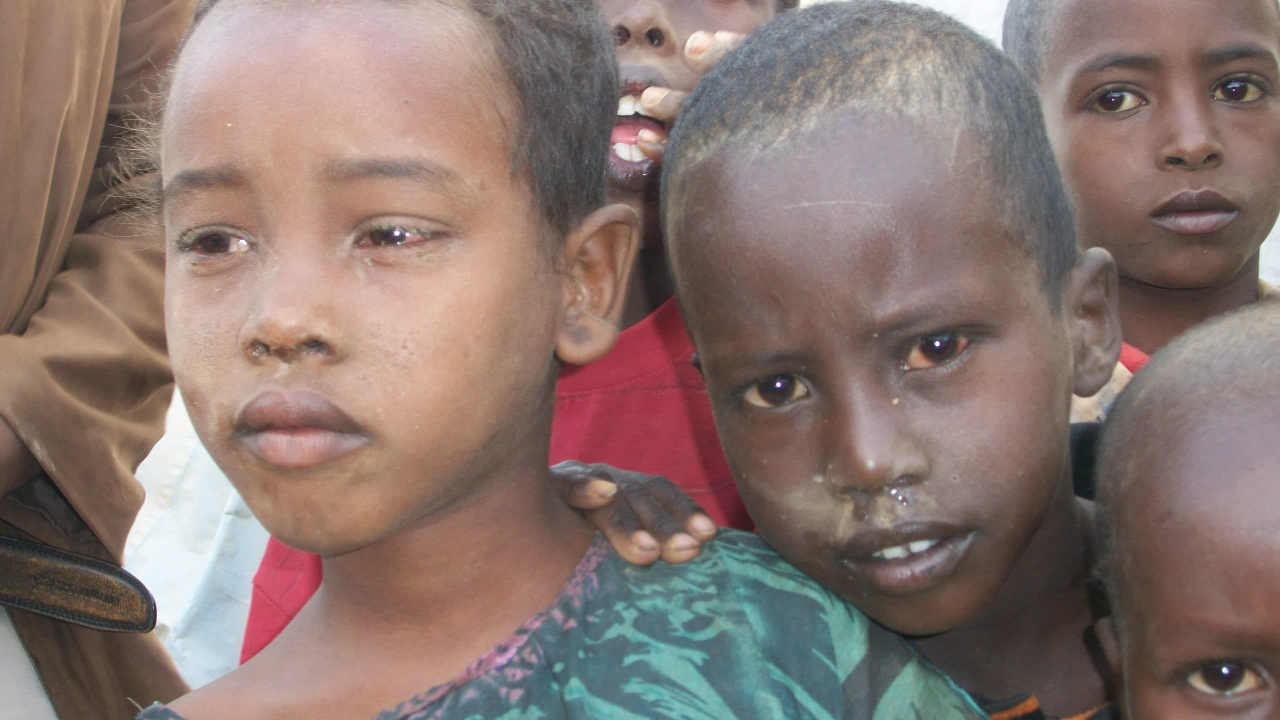Dadaab 2011 (Trip 1)